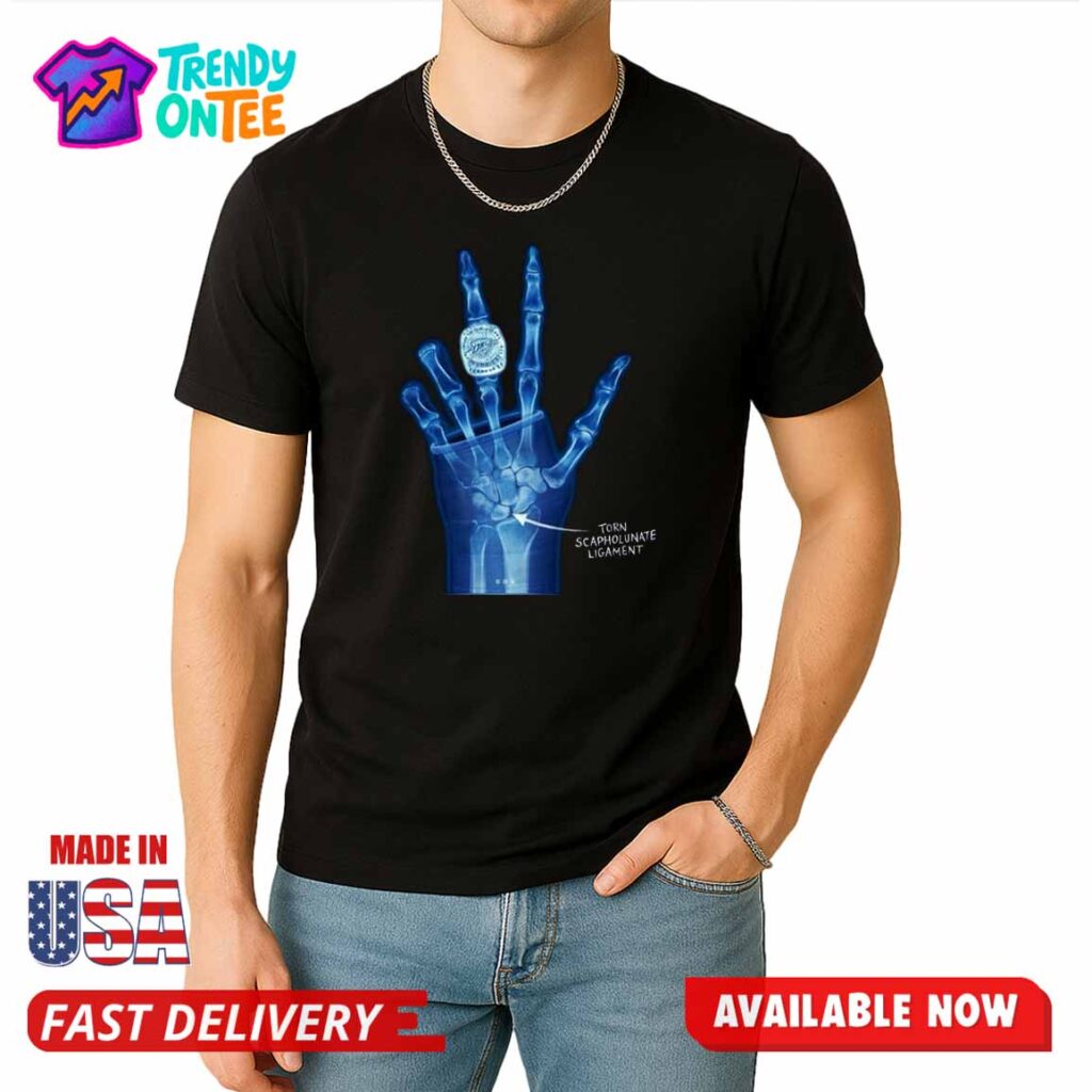 Torn Scapholunate Ligament Shirt